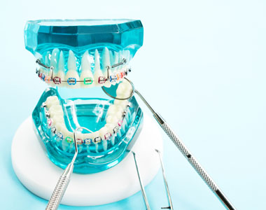 Braces - treatment at westharbor dental  