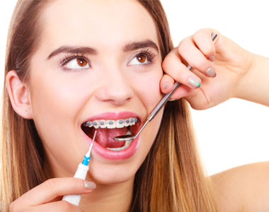 How to keep your braces clean? - treatment at westharbor dental  