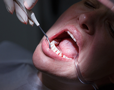 Facts you should know about Gum Disease - treatment at westharbor dental  