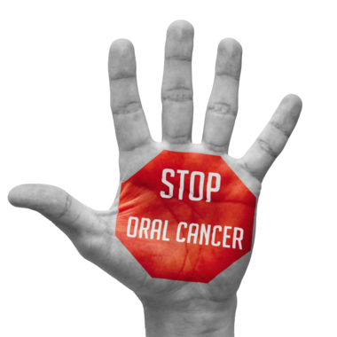 Top 5 Risk Factors for Oral Cancer - treatment at westharbor dental  