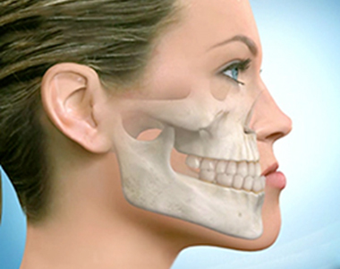 Causes and Treatments for Underbite - treatment at westharbor dental