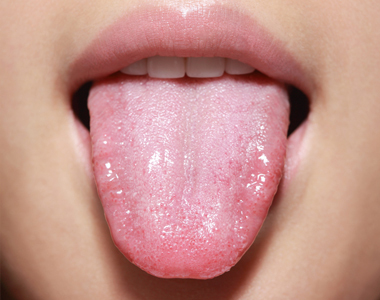 Will cleaning your tongue help reduce the risk of heart disease, arthritis, and other inflammatory diseases? - treatment at westharbor dental  