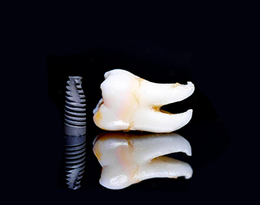 Zygomatic implants - treatment at westharbor dental  