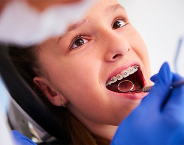 Types of Braces: Which One is Right for You? - treatment at westharbor dental  
