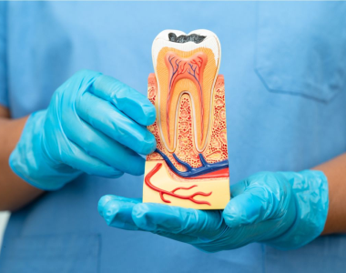 Root Canals: Myths vs. Facts - treatment at westharbor dental  
